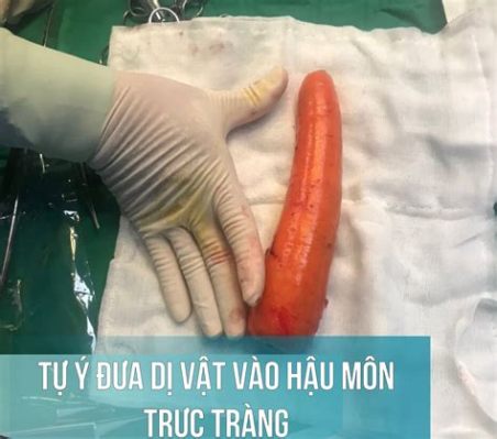 Xàc Quá Khổng Lồ! Bí Ẩn Của Bức Tượng Đá Khổng Lồ Ở Xàtiva